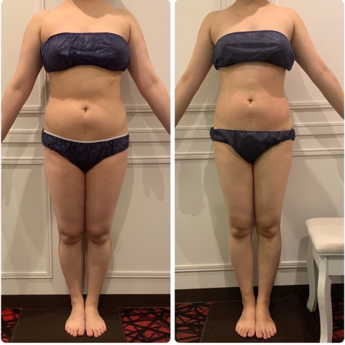 あったかくて気持ちがいい！寝るだけ発汗スリム☆ハイパーナイフEX