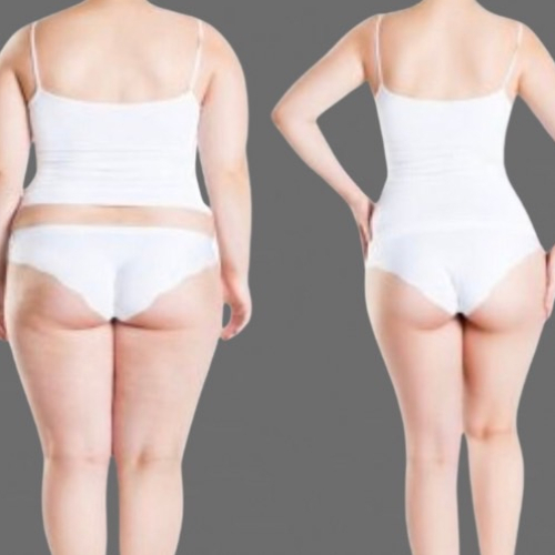 結果出しNO1【E×SプレミアムBody】姿勢矯正×サイズダウン★理想の骨格痩身