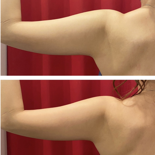 リピート率98％！見た目激変！！痩せる体にチェンジ☆(2回目限定)