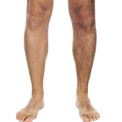 メンズもOK★【人気Ｎｏ1！】全身脱毛（顔・VIOなし）￥11000　回数：1回