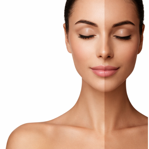 New☆【トラブル肌改善】REVI陶肌ピール★～美肌作り～¥11000[ニキビ/毛穴]