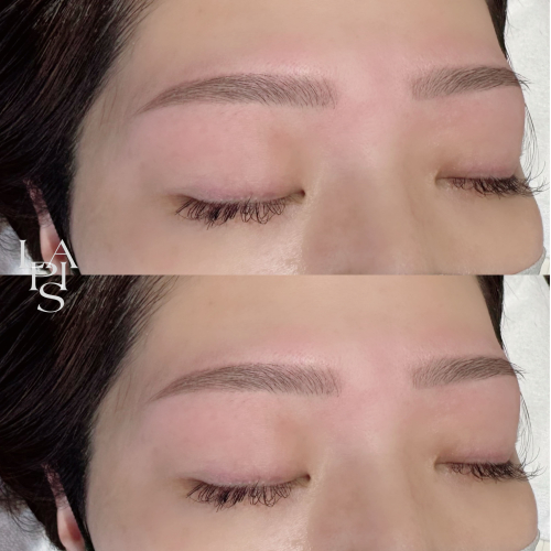 ハリウッドブロウリフト